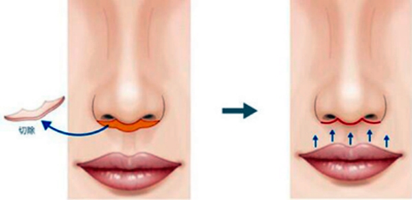 李澤人中縮短價(jià)格