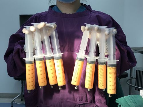 深圳脂肪填充有名的醫(yī)院排名