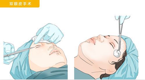 為啥叫“劉志剛眼王”