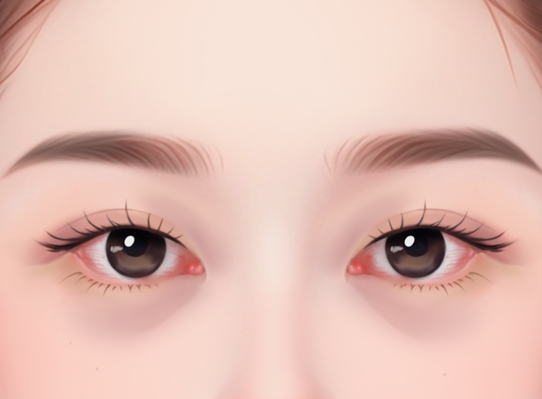 成都楊迪筋膜提升靠譜嗎