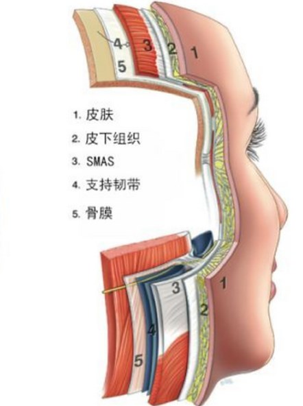成都楊迪筋膜提升靠譜