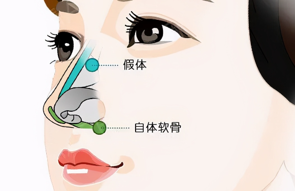 劉彥軍是北京哪個(gè)醫(yī)院的鼻整形醫(yī)生