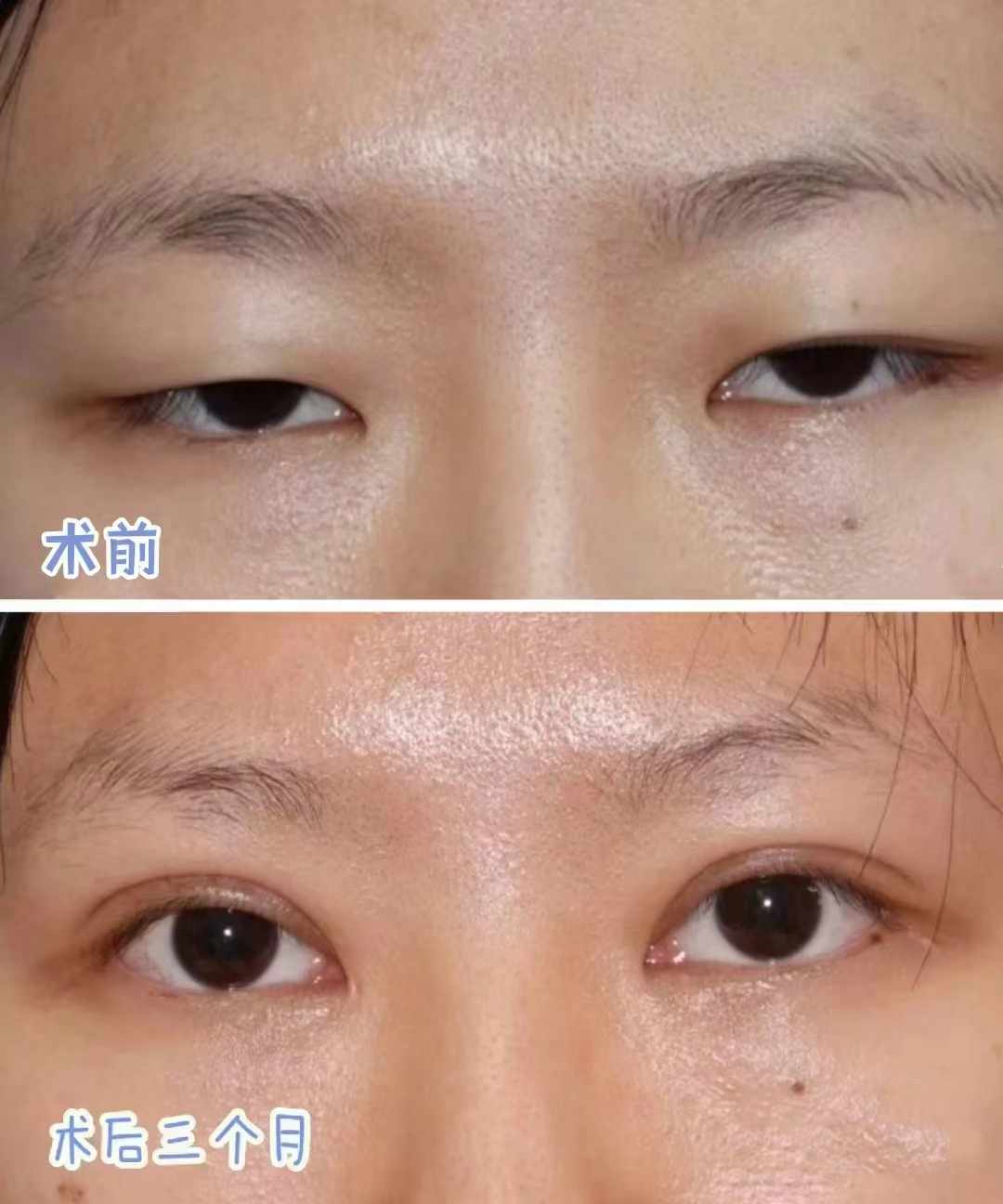 一、廣州廣大醫(yī)院吳訓(xùn)醫(yī)生簡(jiǎn)介