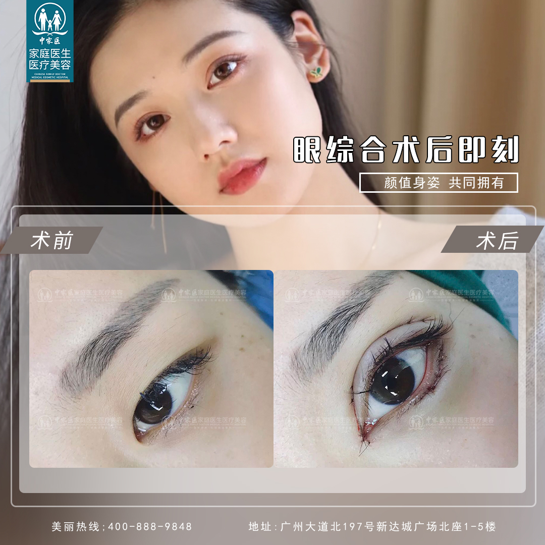 三、廣州廣大醫(yī)院吳訓(xùn)醫(yī)生正頜技術(shù)亮點(diǎn)www.66ub.cn