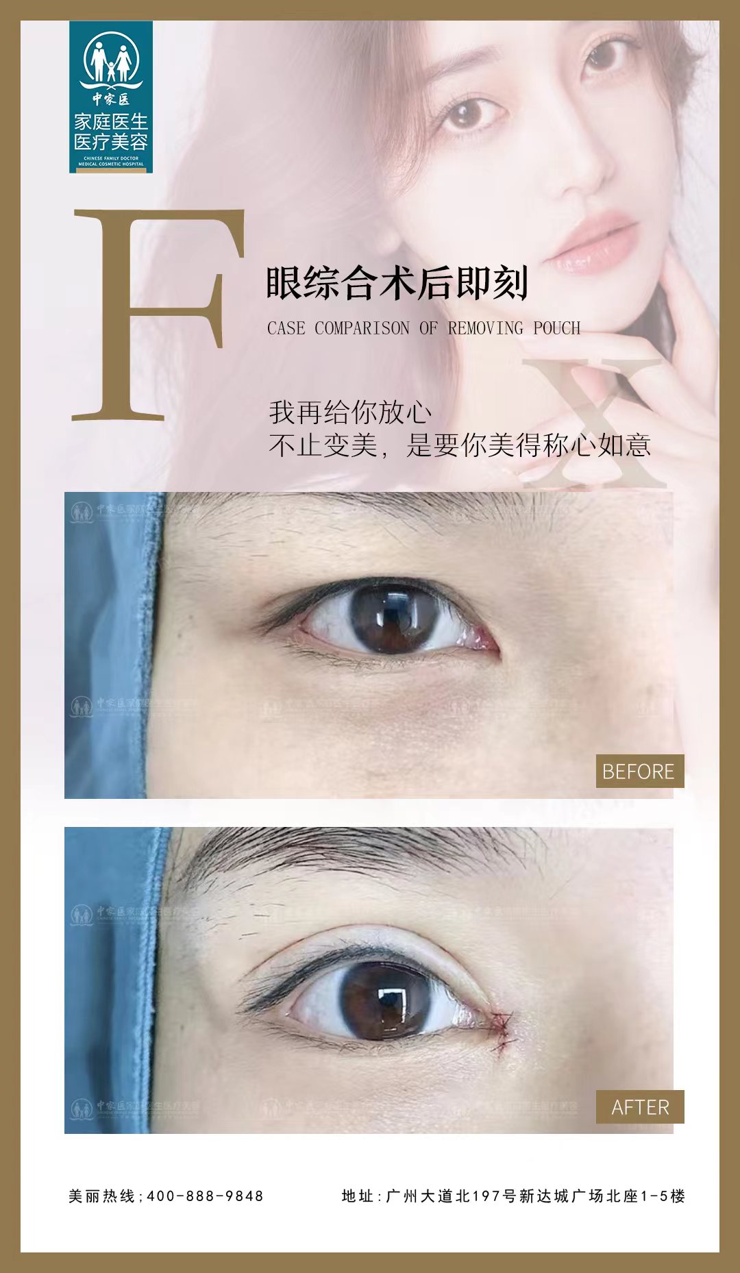 四、廣州廣大醫(yī)院正頜手術(shù)價(jià)格詳情