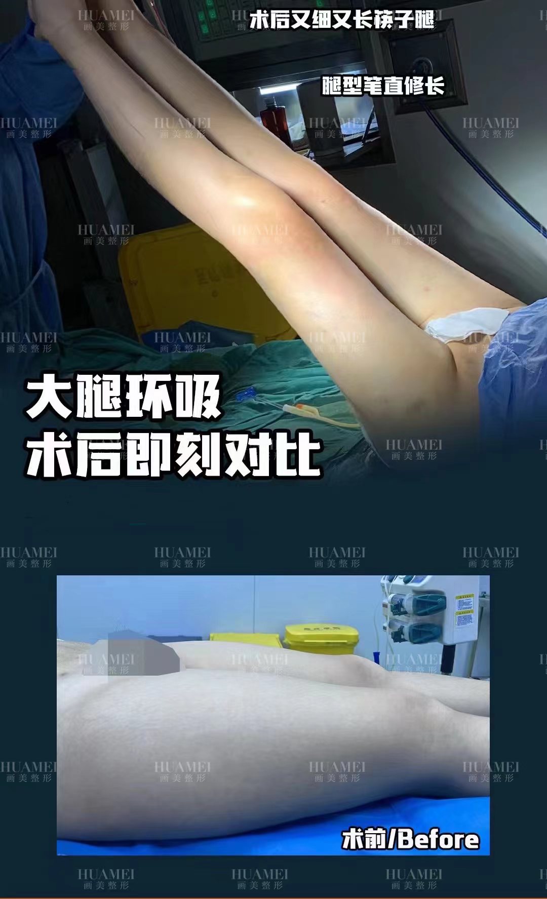 三、羅海軍 醫(yī)生：注重細(xì)節(jié)的吸脂骨干醫(yī)生www.66ub.cn