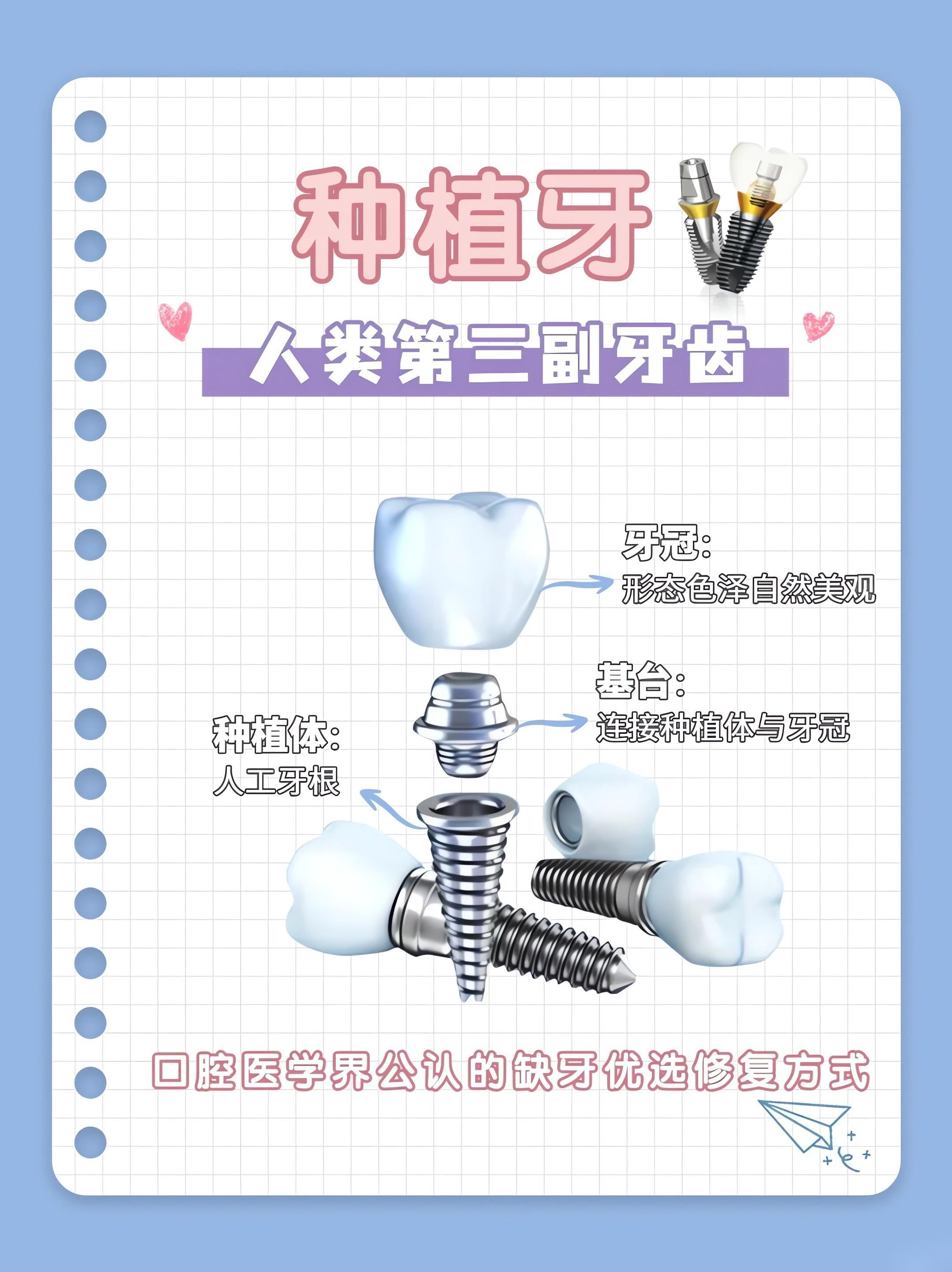 西安市周至縣種植醫(yī)院的透明收費(fèi)體系