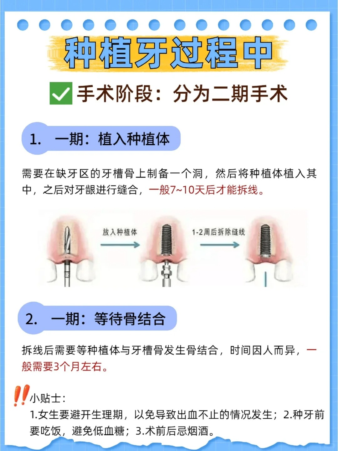 選擇廣州廣大口腔醫(yī)院張國平主診的德國貝格種植牙有哪些保護(hù)？www.66ub.cn