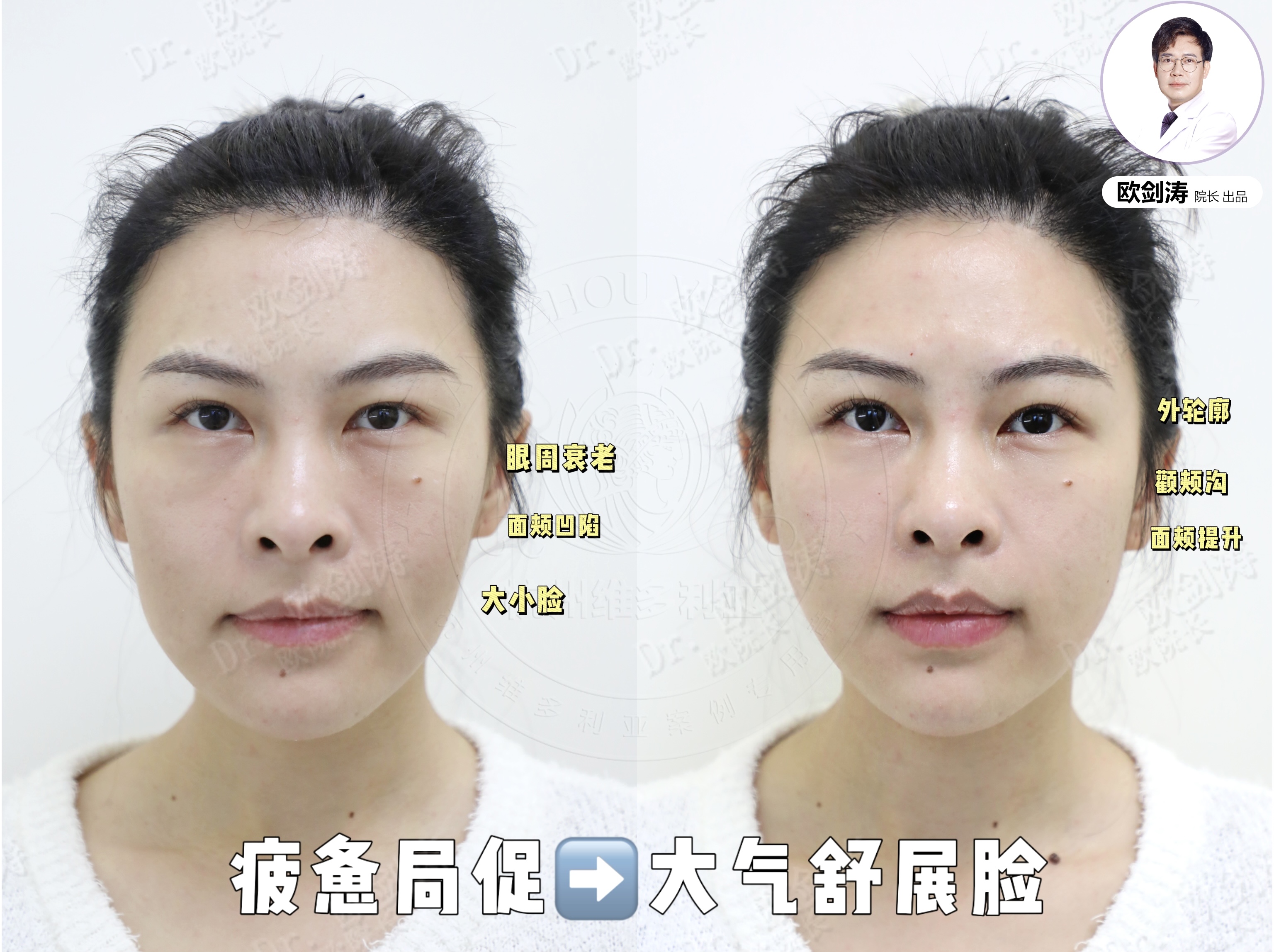 總結(jié)饅化臉修復(fù)要點(diǎn)