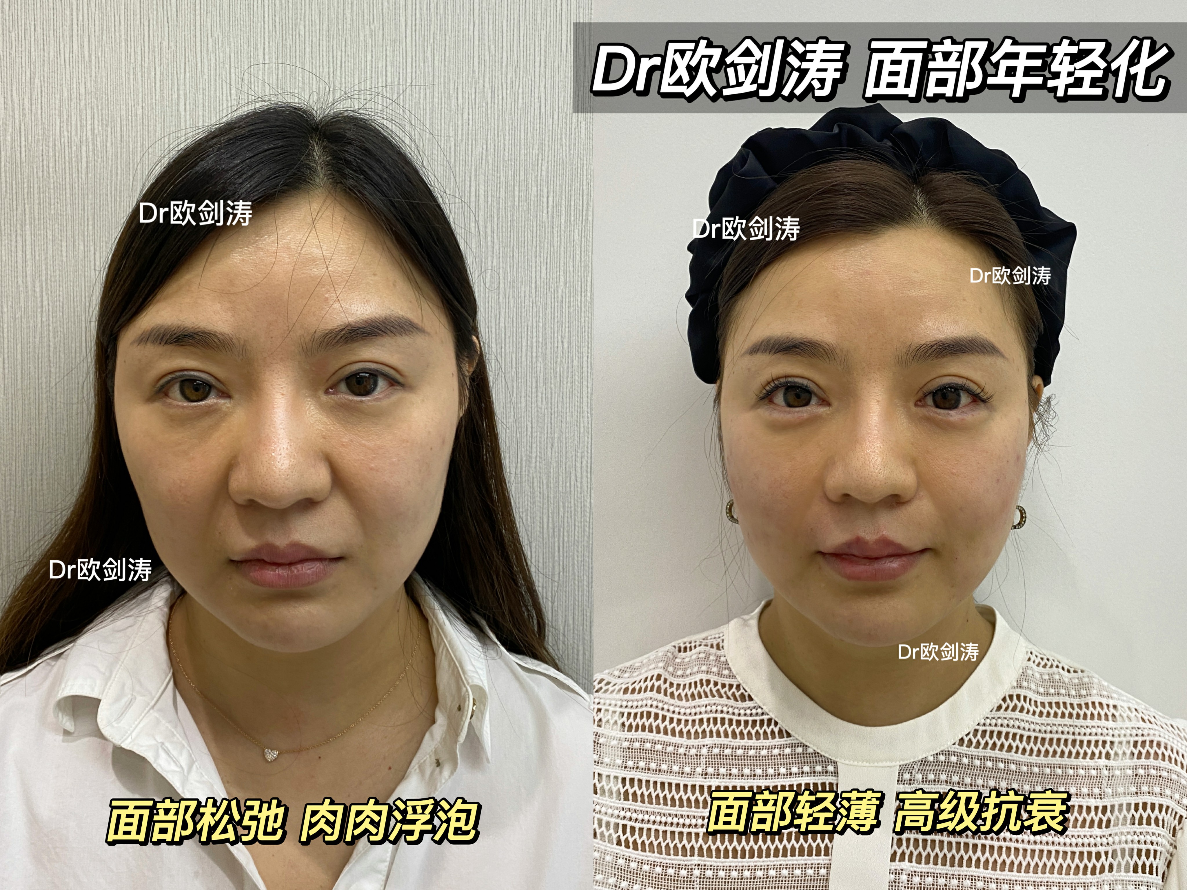 蔣錚錚醫(yī)生審美與服務(wù)理念優(yōu)質(zhì)