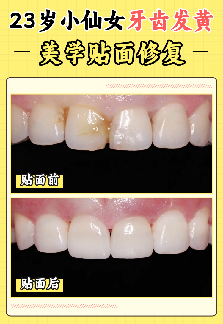 廣州市廣大口腔醫(yī)院是民營醫(yī)院嗎？具有影響力信息解答