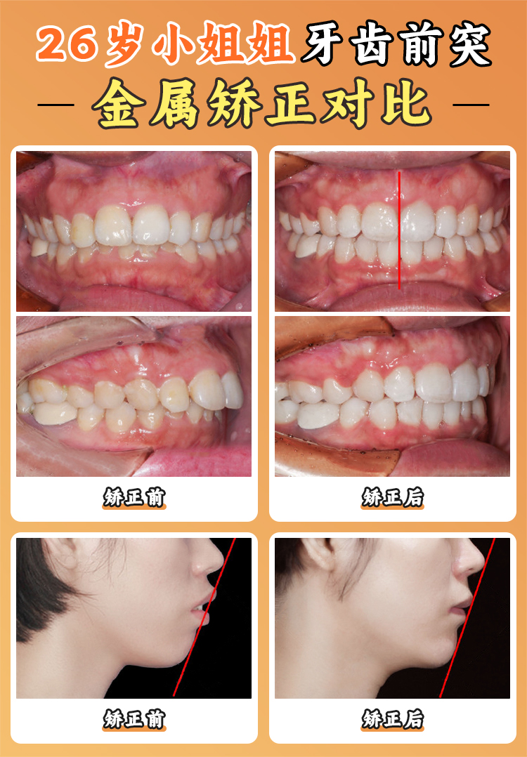 廣州市廣大口腔醫(yī)院的收費標準透明嗎？
