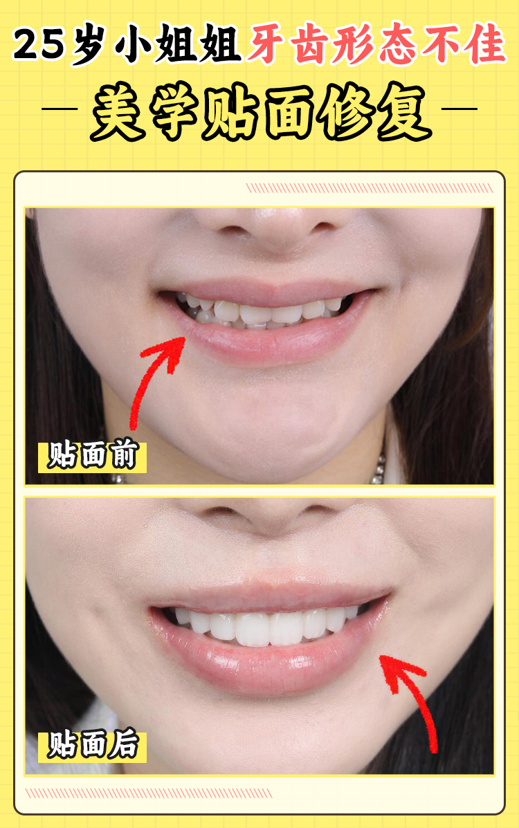 寧鄉(xiāng)天天牙科醫(yī)院隱形牙套與其他矯正方式的價(jià)格對(duì)比