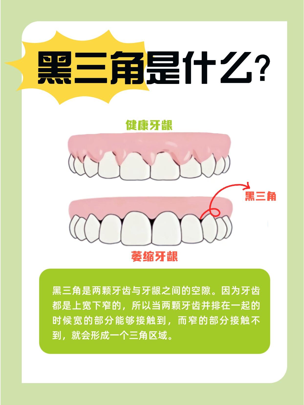 寧鄉(xiāng)天天牙科醫(yī)院隱形牙套的品牌選擇及價(jià)格差異