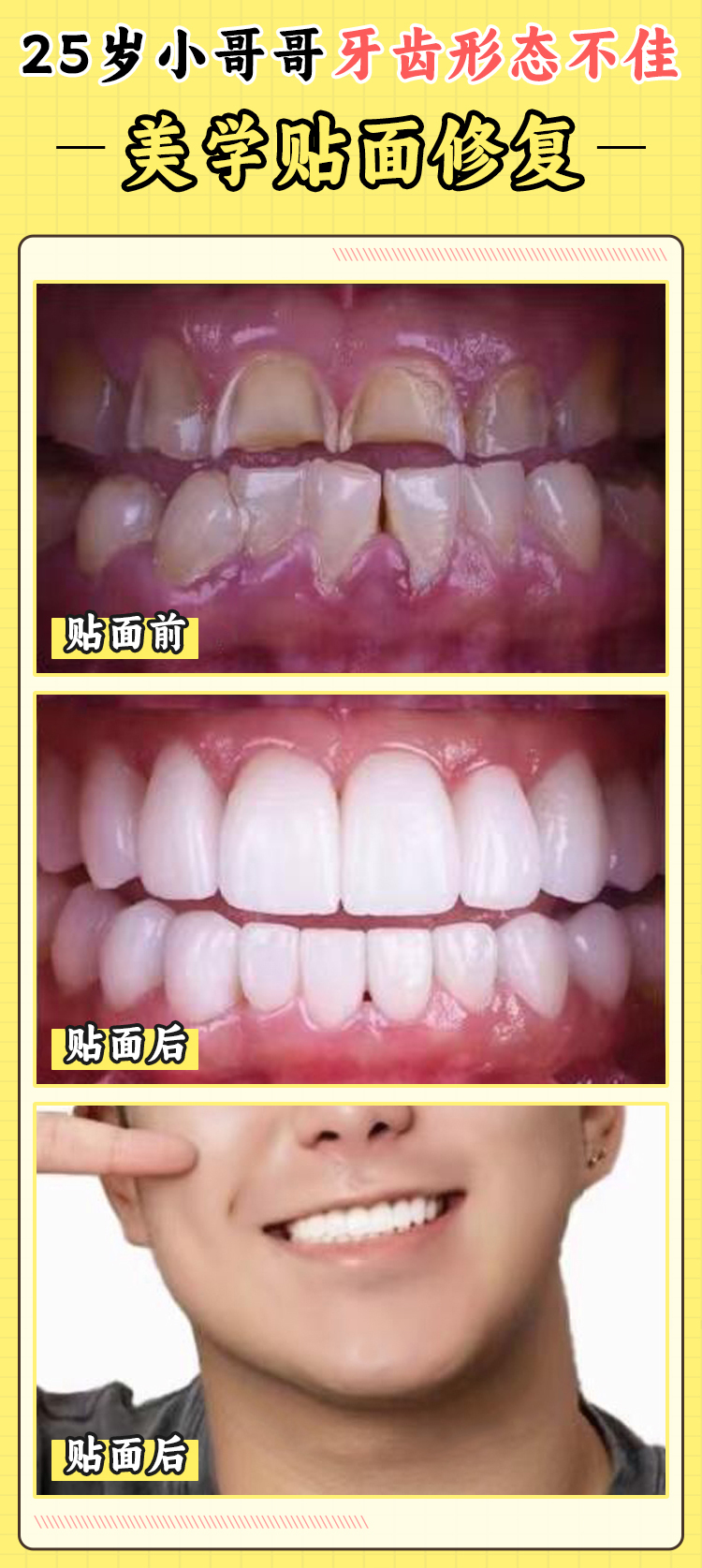 二、貴州醫(yī) 科 大學附屬口腔醫(yī)院預(yù)約掛號注意事項