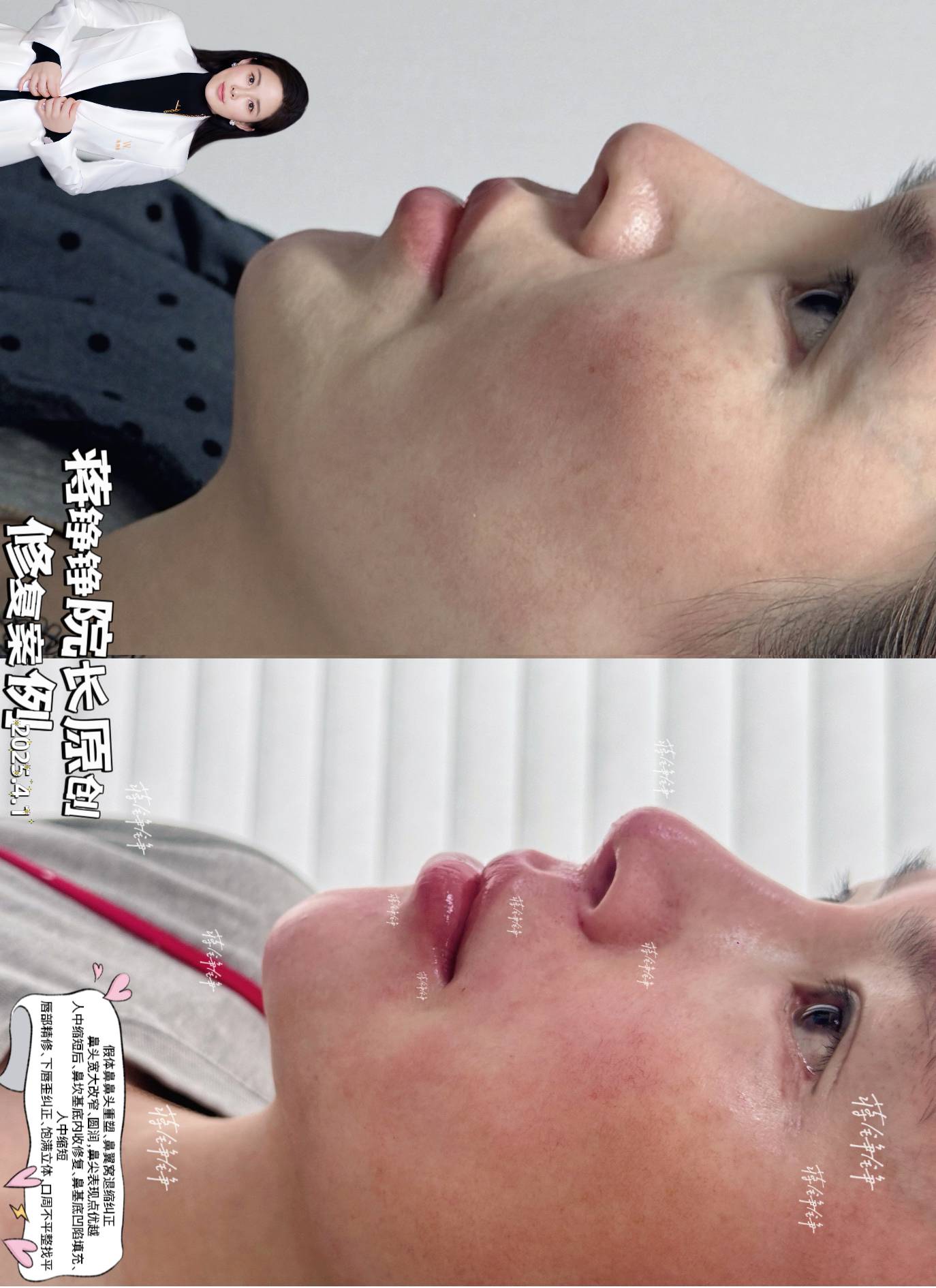 2026武漢面部懸吊筋膜提升醫(yī)院排名前十——武漢藝星整形美容醫(yī)院