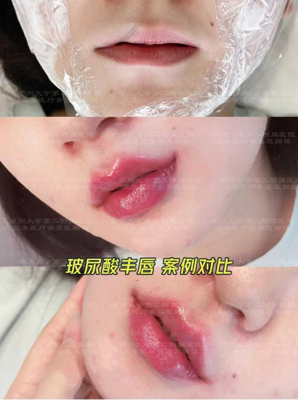 于艷菊手術(shù)怎么預(yù)約？三種方式任你選