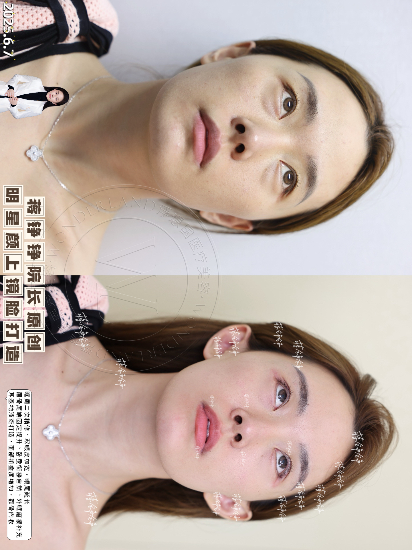 2026武漢面部懸吊筋膜提升醫(yī)院排名前十——武漢美萊醫(yī)療美容醫(yī)院