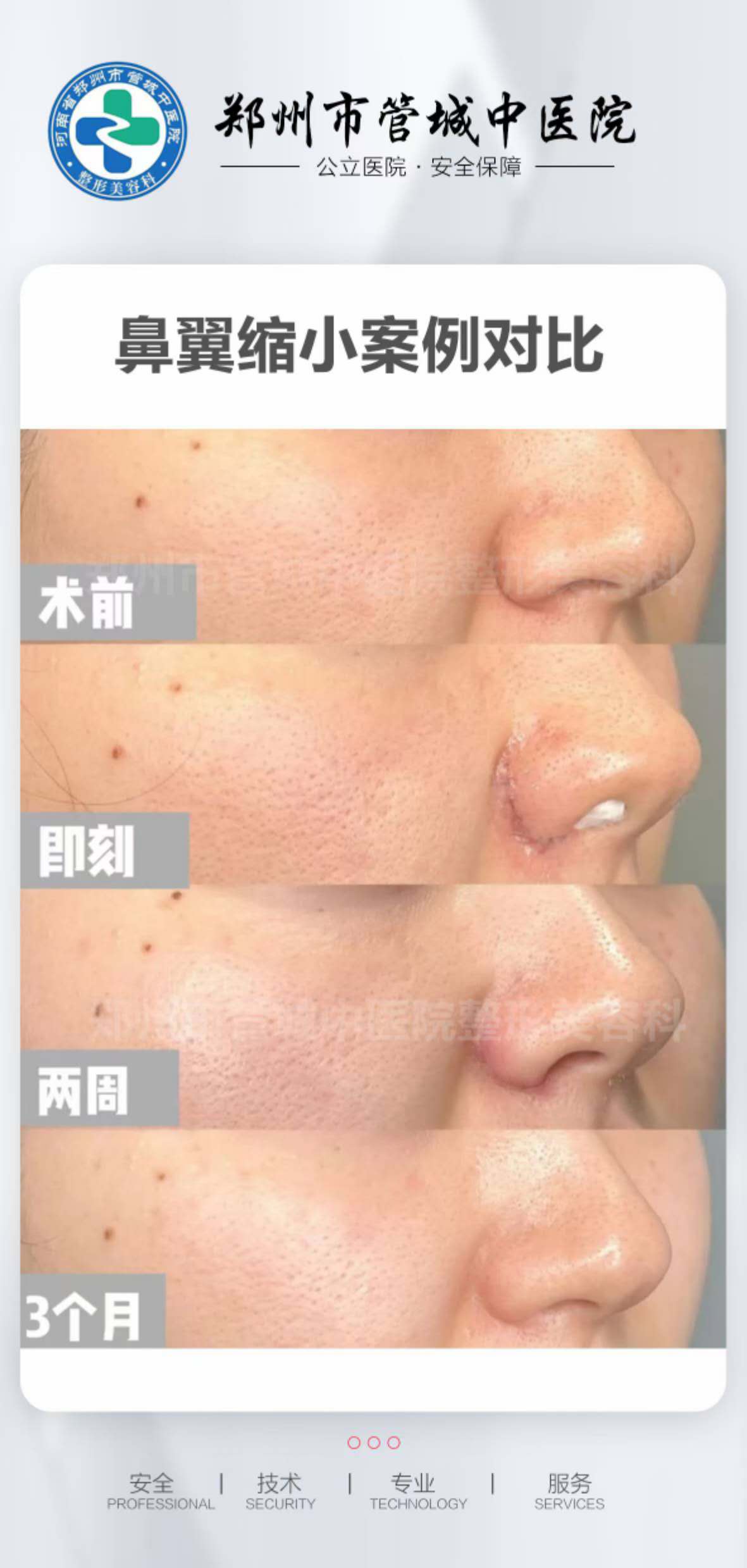 芊美醫(yī)療美容：“修復(fù)圣手”打造自然臉型