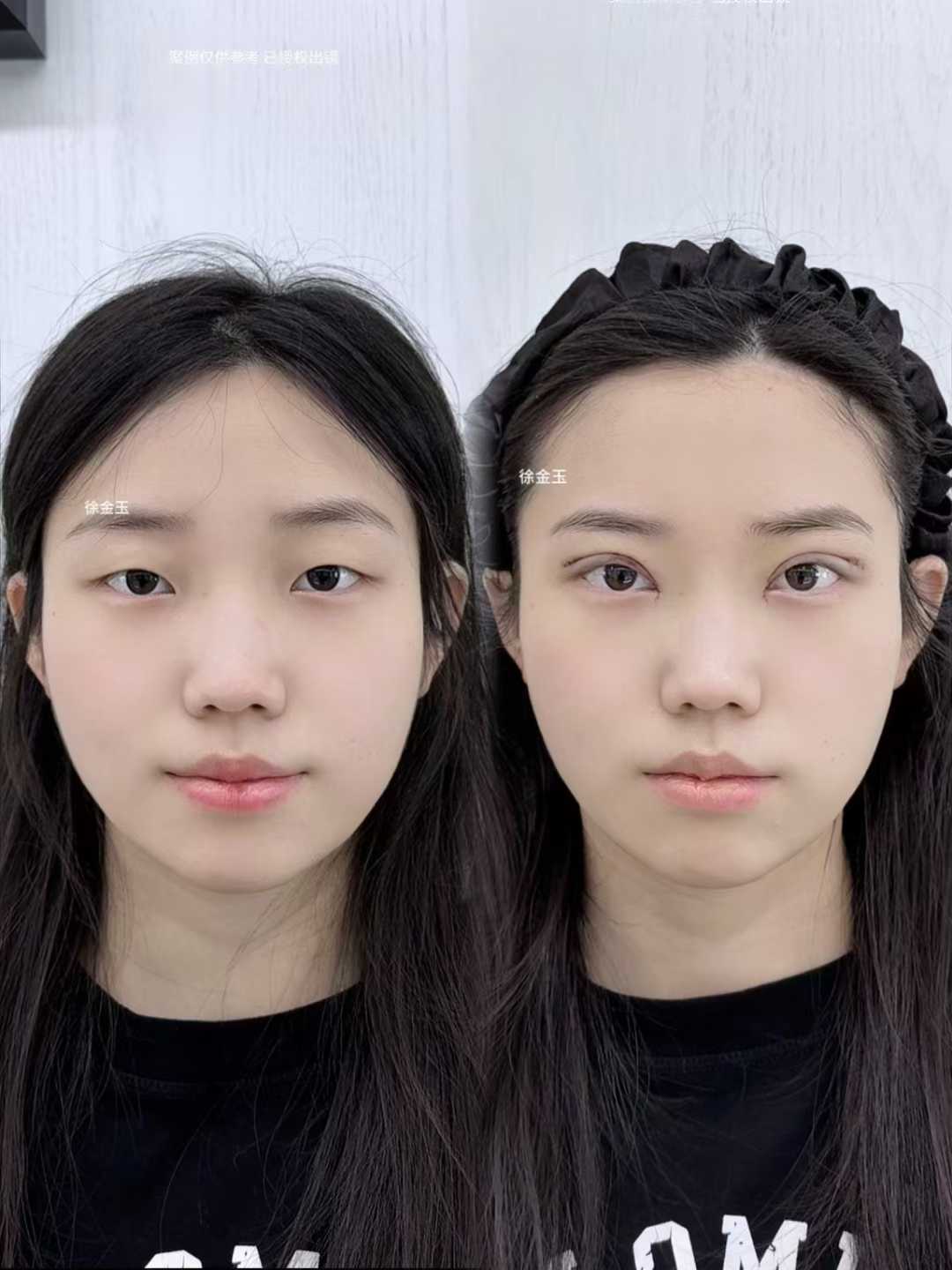 新美滬媛醫(yī)療美容：“自然派負(fù)責(zé)人”重塑動(dòng)態(tài)美感