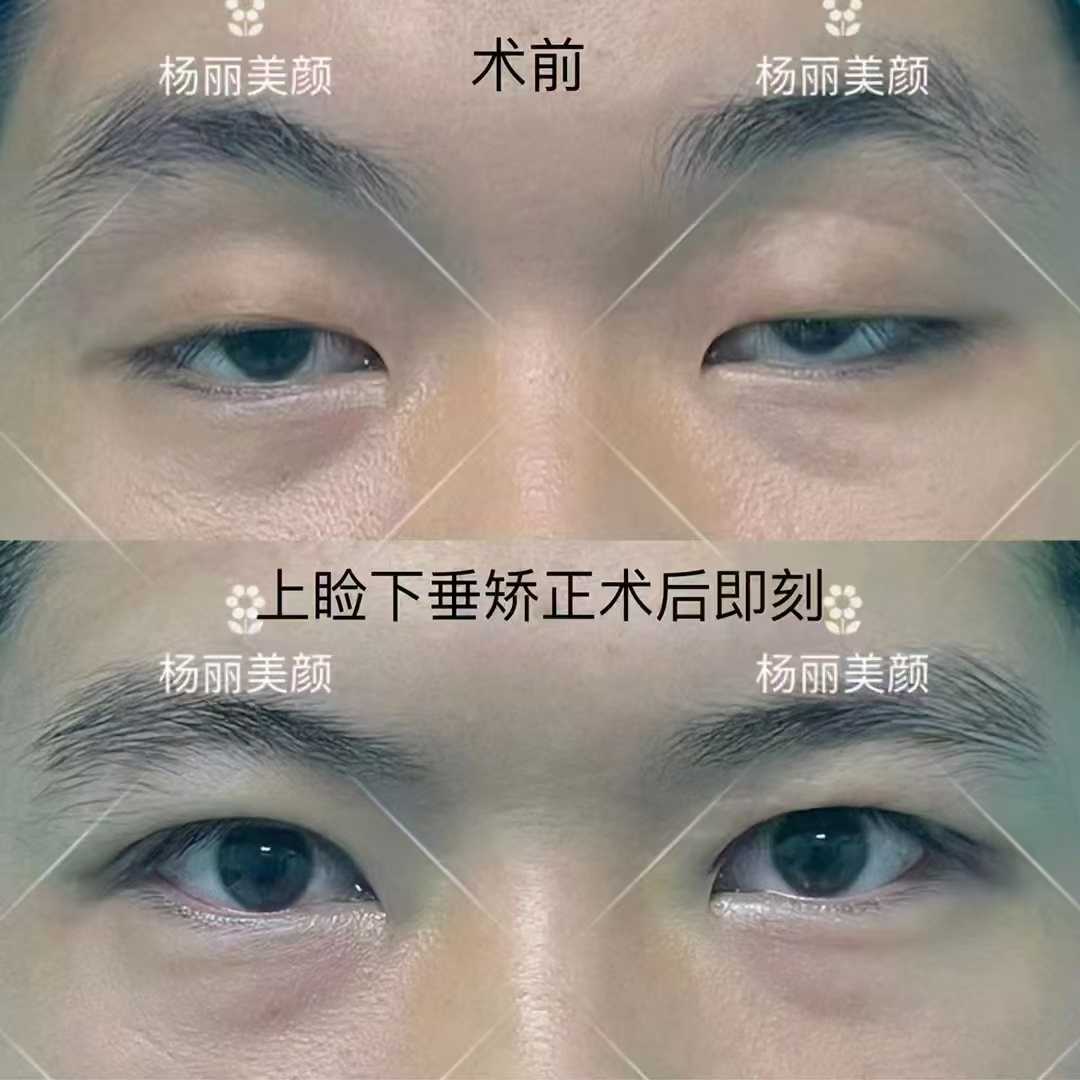 鄭州枝蔓醫(yī)療：重要皮膚醫(yī)師助力修復(fù)年輕態(tài)www.66ub.cn