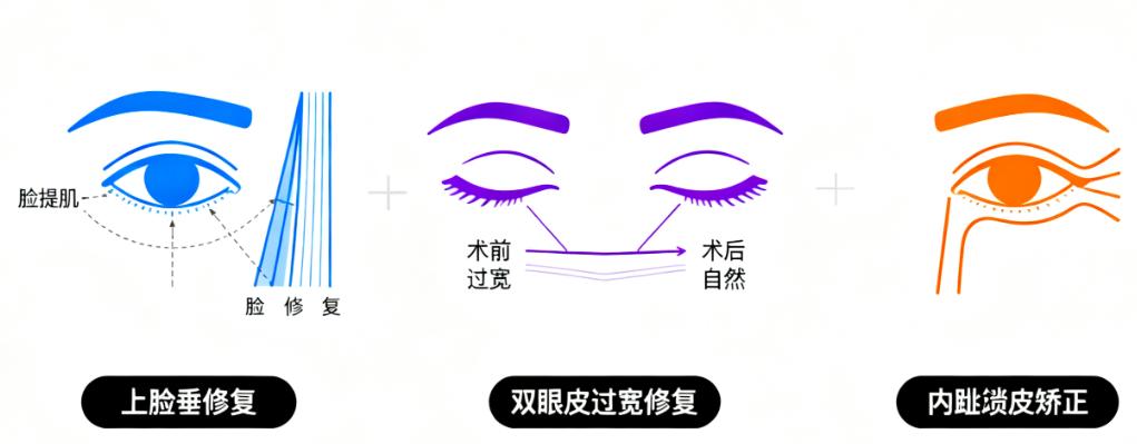 杜園園和張冰潔修復(fù)眼袋誰好