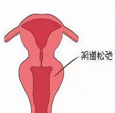 適合人群有哪些？這5類女性別錯(cuò)過！