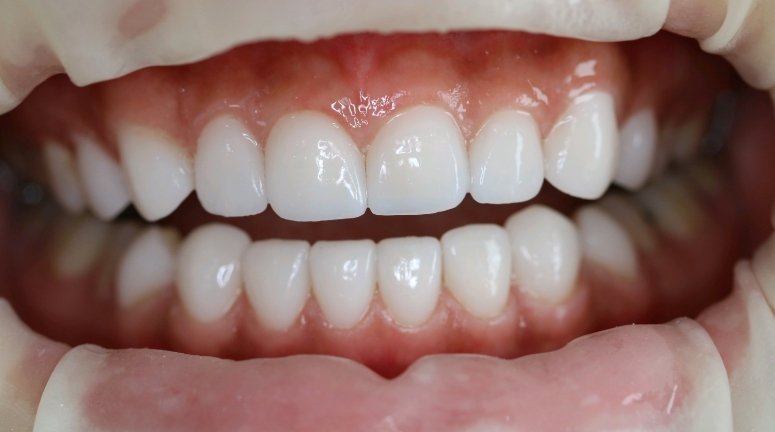 通過(guò)北京貝拉圖思口腔電話預(yù)約注意事項(xiàng)