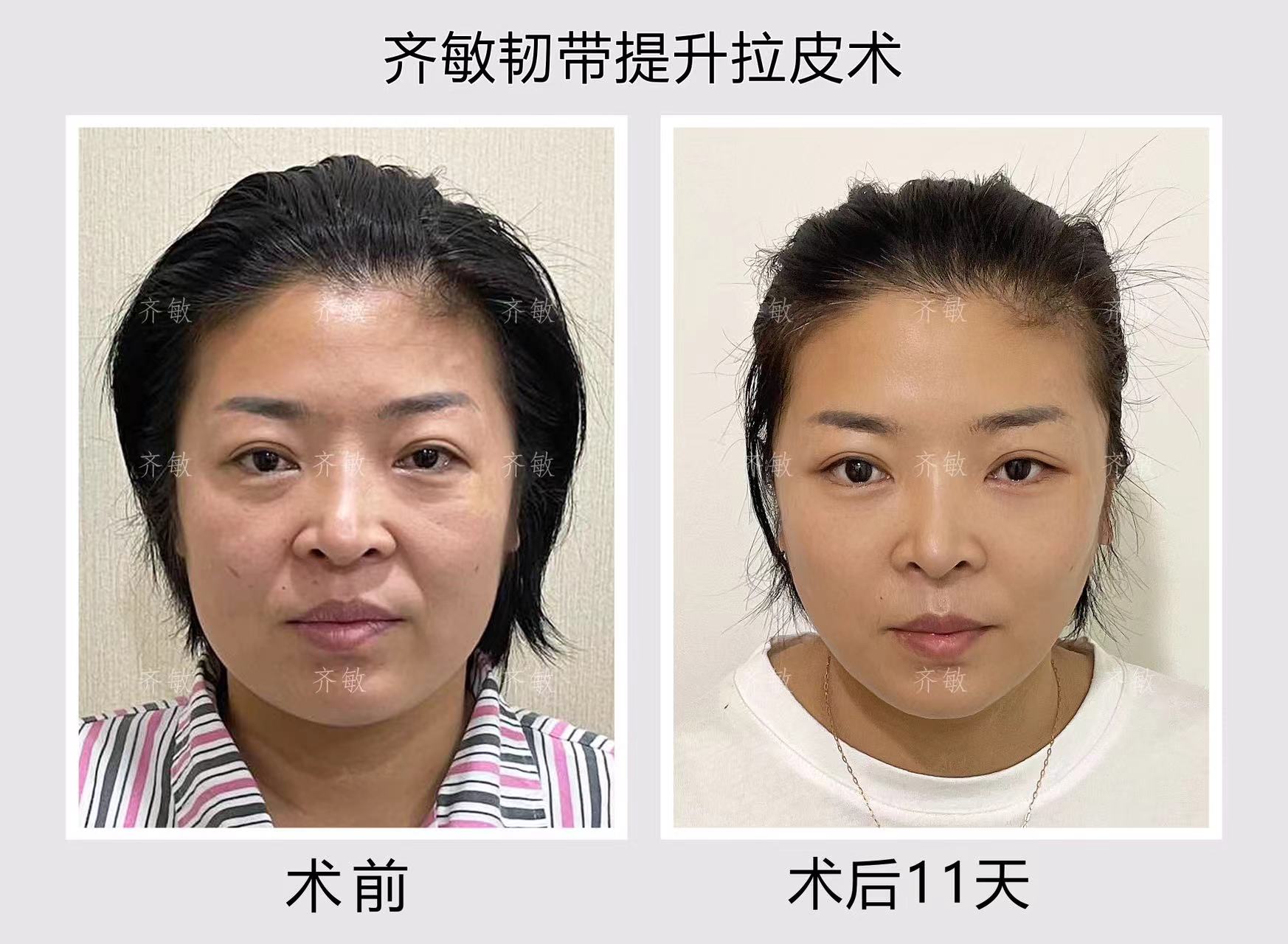 二、拉薩愛思特醫(yī)療美容醫(yī)院交通指南