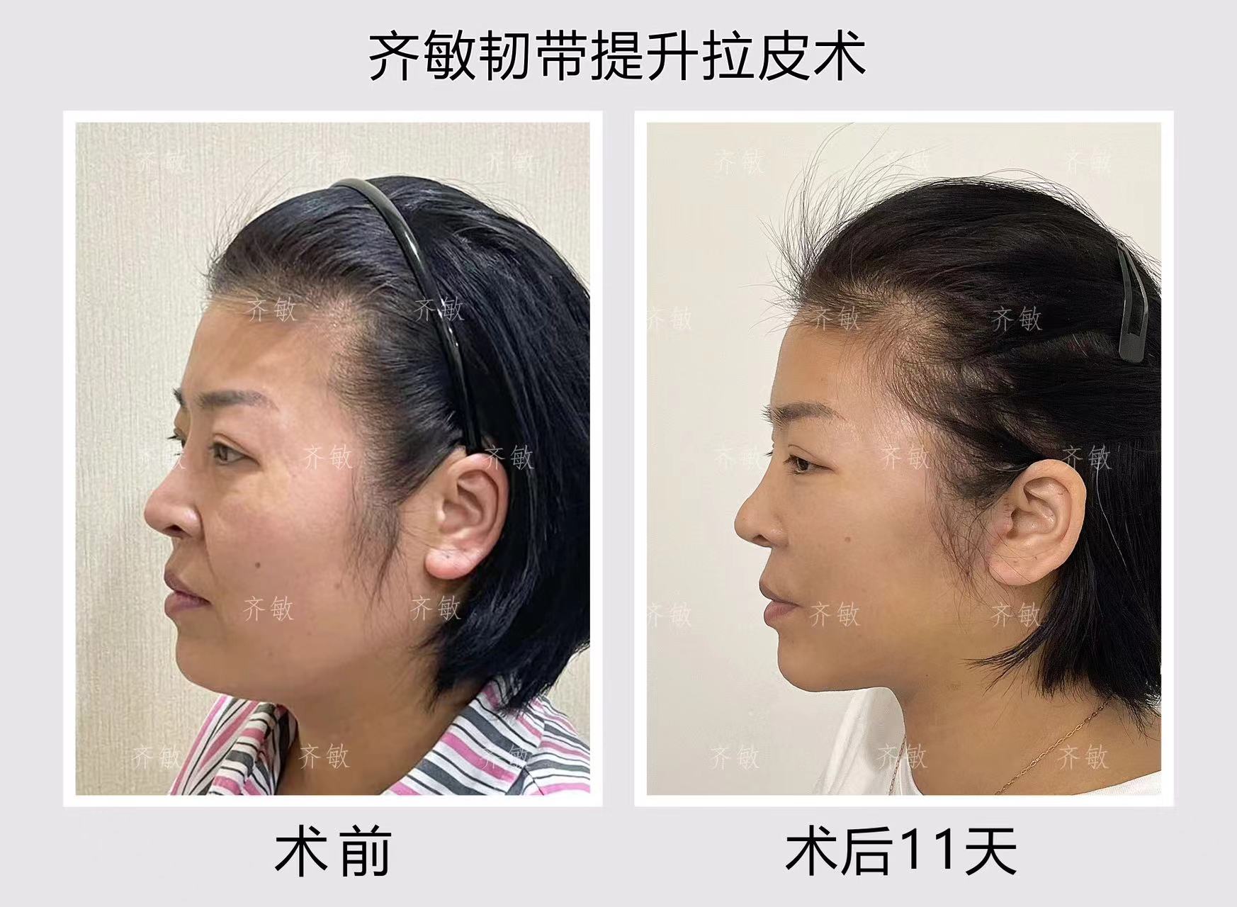 三、拉薩愛思特醫(yī)療美容醫(yī)院簡介與資質