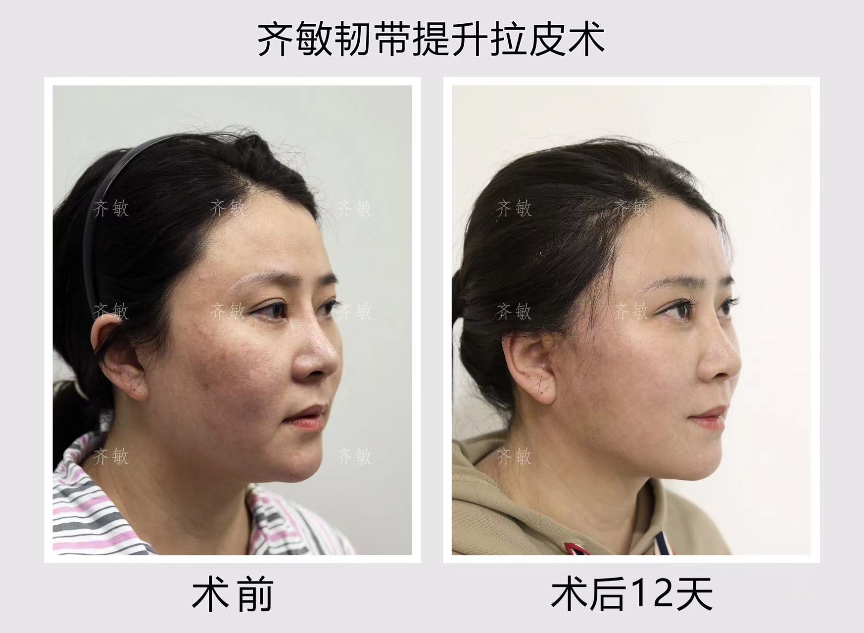 六、拉薩愛思特醫(yī)療美容醫(yī)院優(yōu)勢與服務特色