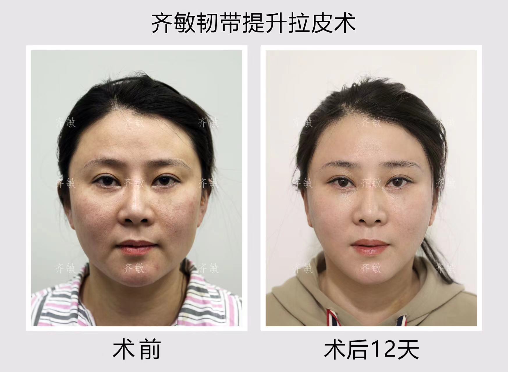 七、拉薩愛思特醫(yī)療美容客戶評價與口碑