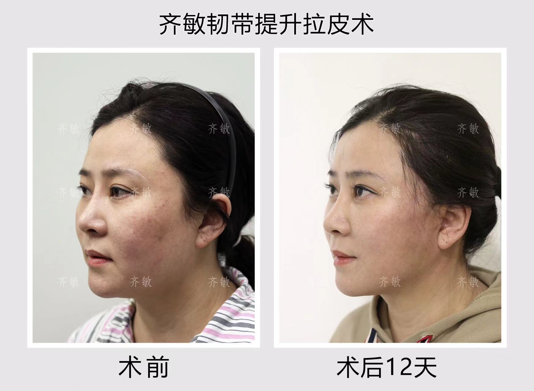 八、拉薩愛思特醫(yī)療美容整形常見問題解答