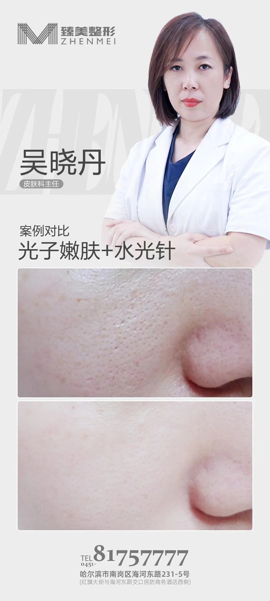 二、上海九院光子嫩膚價(jià)格背后的技術(shù)支撐