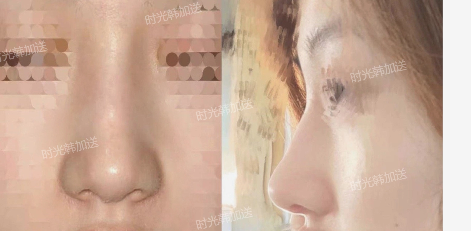 上海徐懷河做小切口提升的專精技術體現(xiàn)在哪些方面？