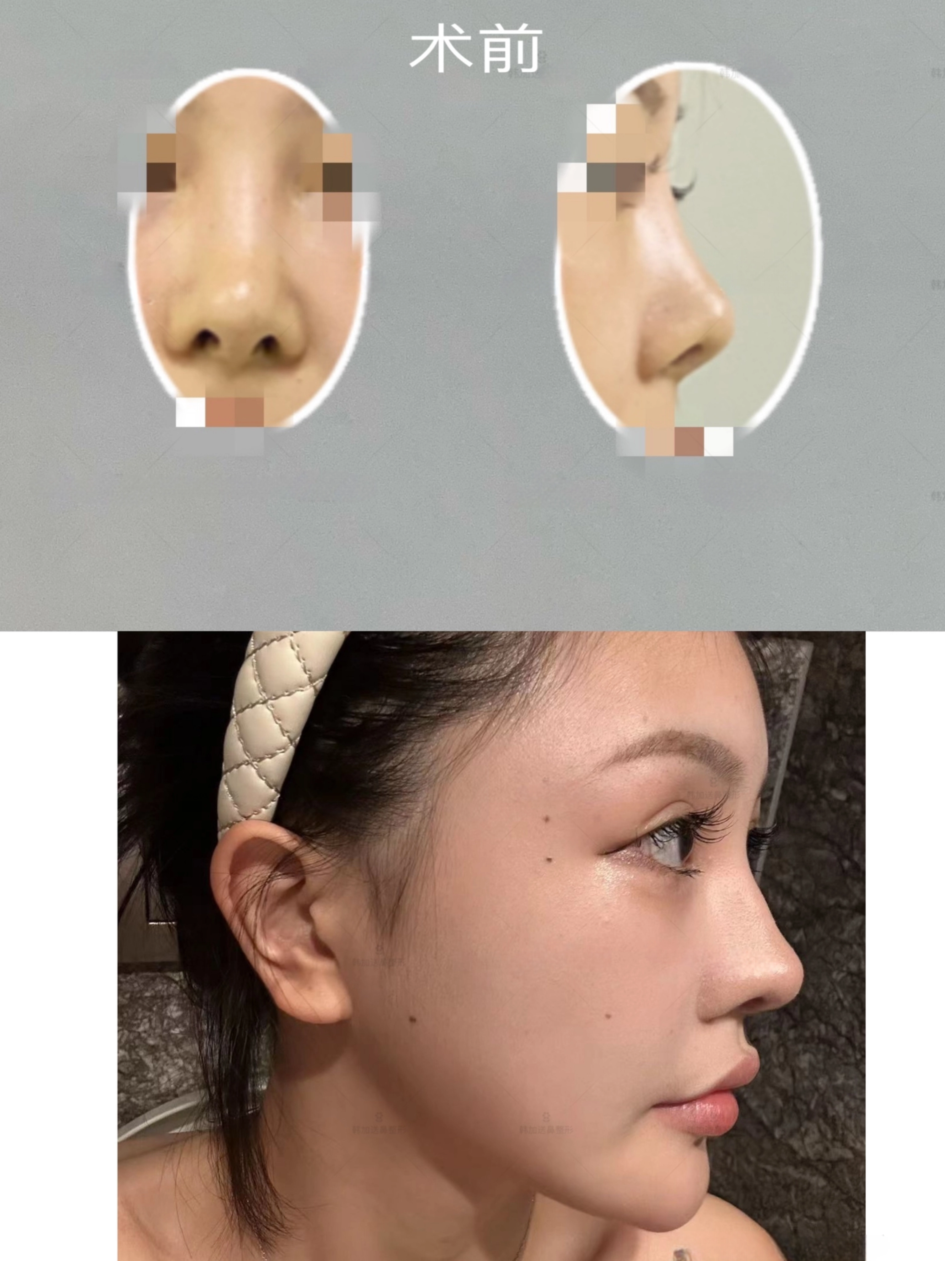 上海徐懷河豐富的經(jīng)驗對小切口提升有什么幫助？