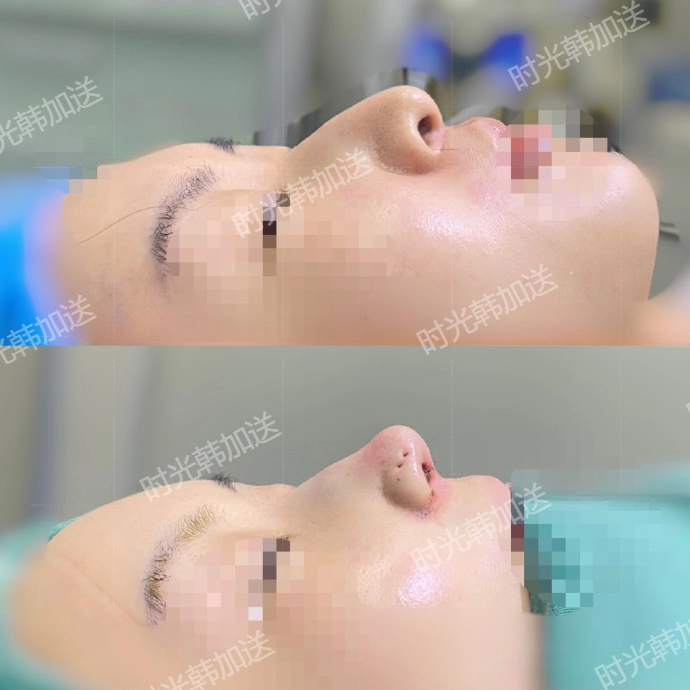 上海徐懷河做小切口提升的實例成效如何？