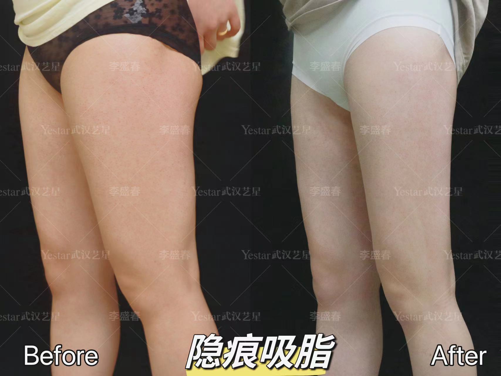 羅盛康坐診醫(yī)院與患者口碑