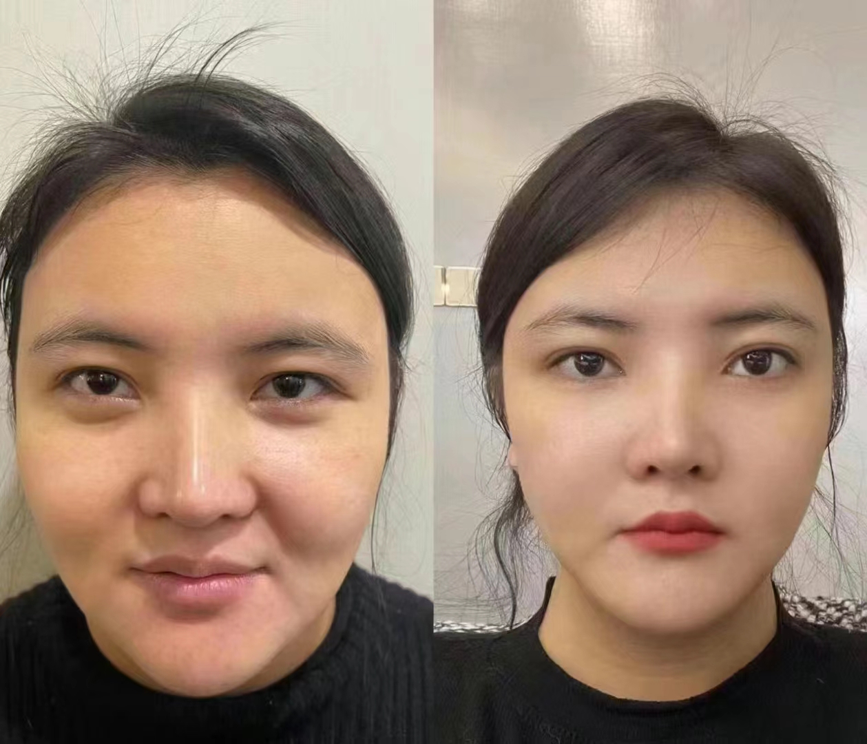 成都潘多拉醫(yī)療美容整形醫(yī)院：口碑良好，綜合改善