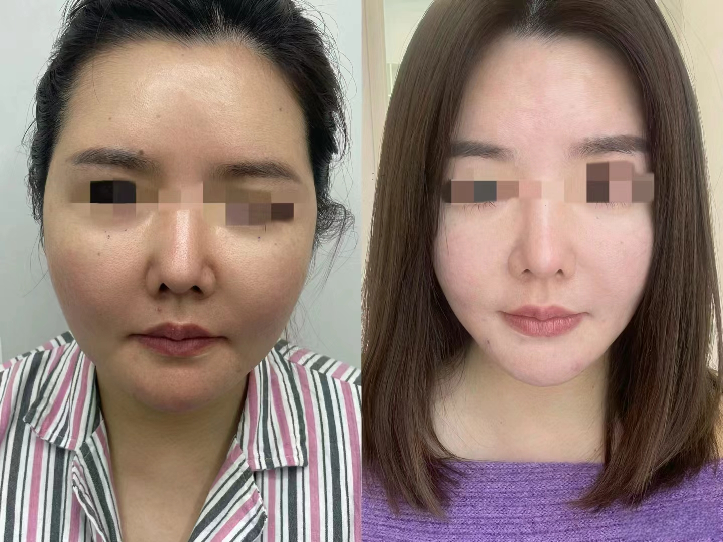 成都美容整形醫(yī)院疤痕科：早期先驅(qū)，激光祛疤專長