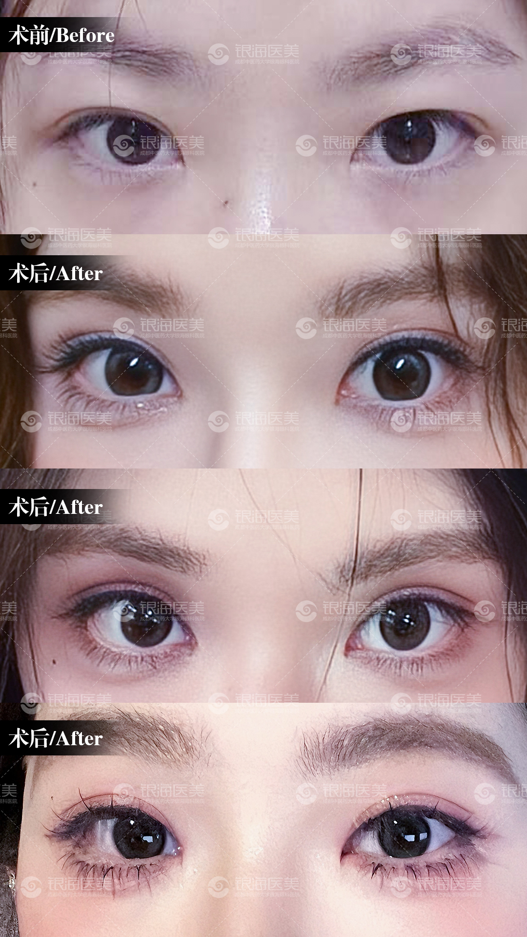 四川成都疤研疤痕門診：多年沉淀，特色治療