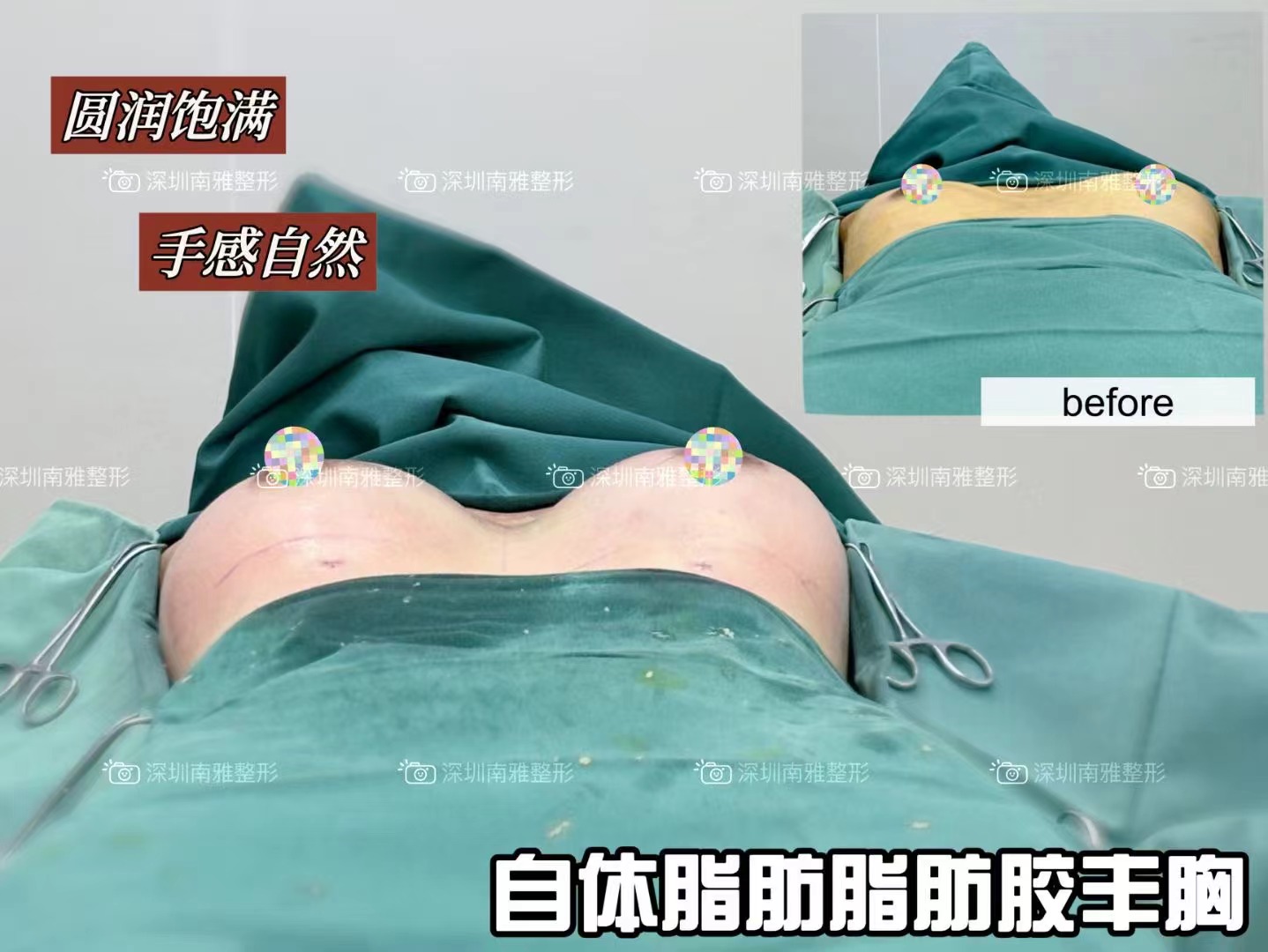 羅盛康技術(shù)特色與行業(yè)影響