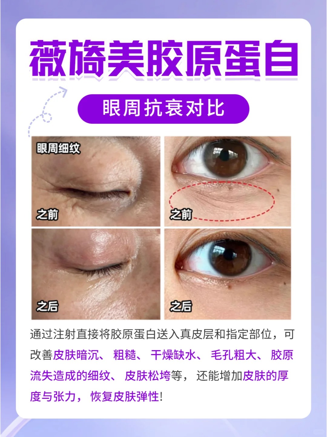 國產(chǎn)膠原蛋白品牌核心技術(shù)揭秘