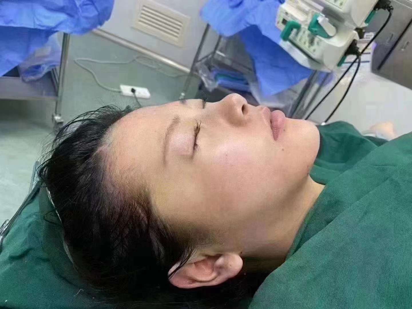 廣州雅貝壹醫(yī)療吸脂技術(shù)的價格合理嗎？