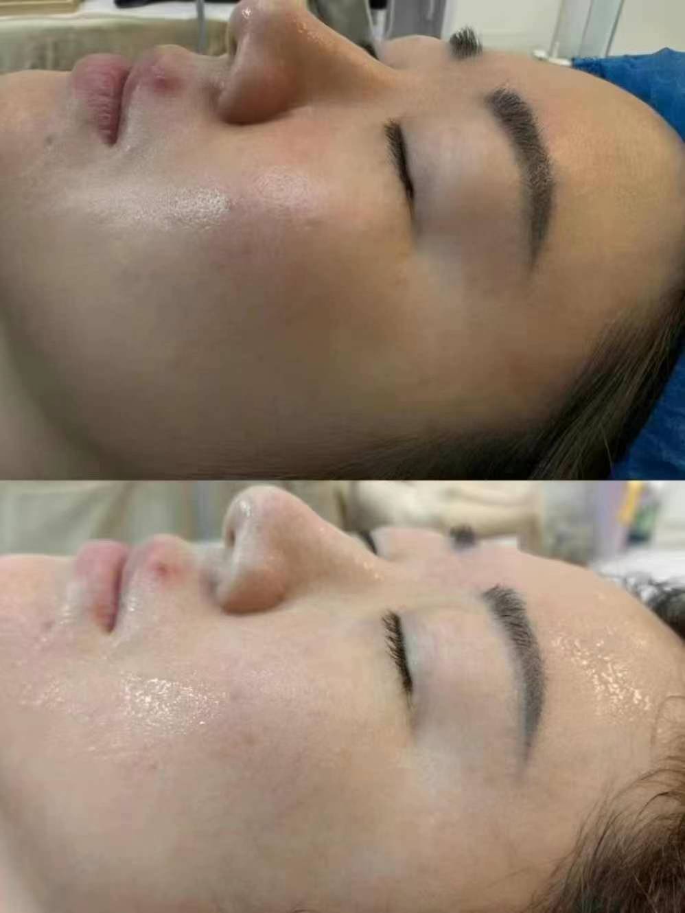 三、上海九院光子嫩膚價(jià)格與其他醫(yī)院的對(duì)比