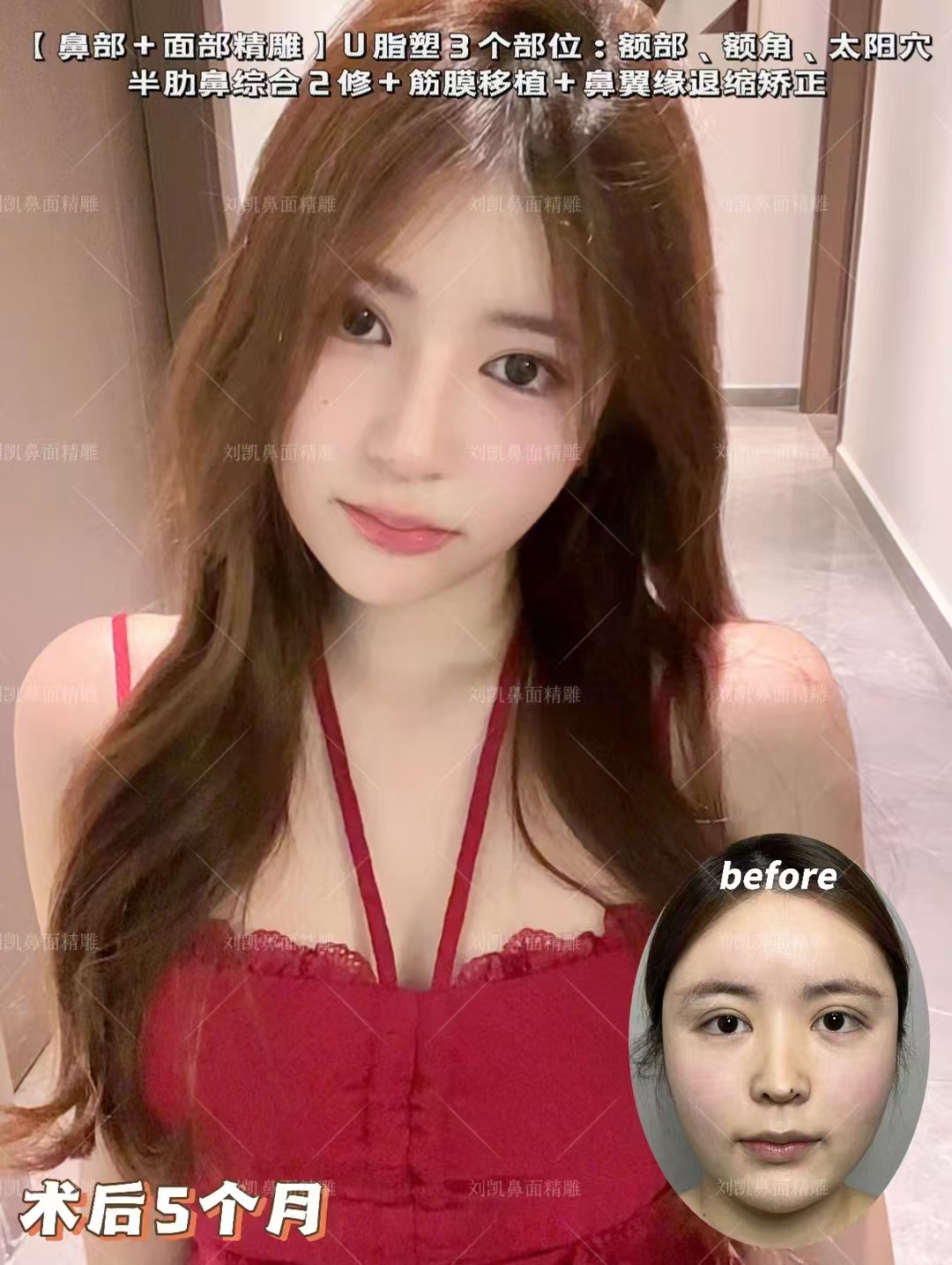 不同修復(fù)方法的價(jià)格對(duì)比