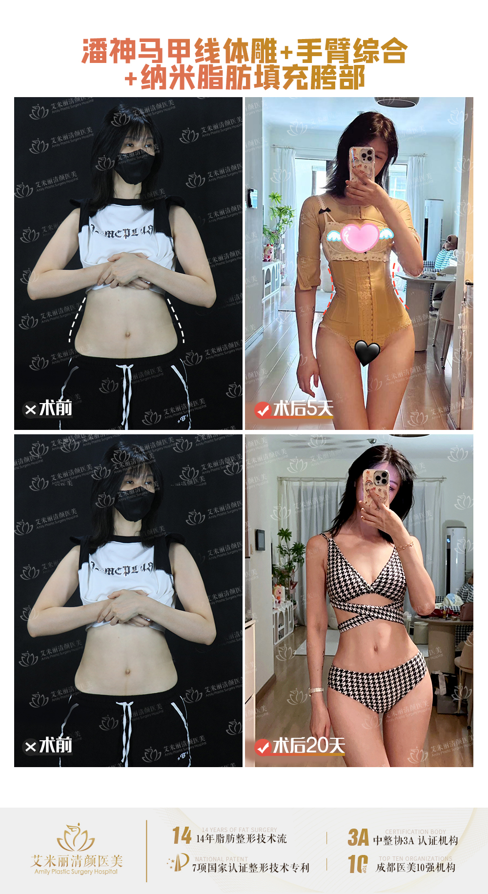 二、成都西區(qū)醫(yī)院宋華敬拉皮手術(shù)技術(shù)特點