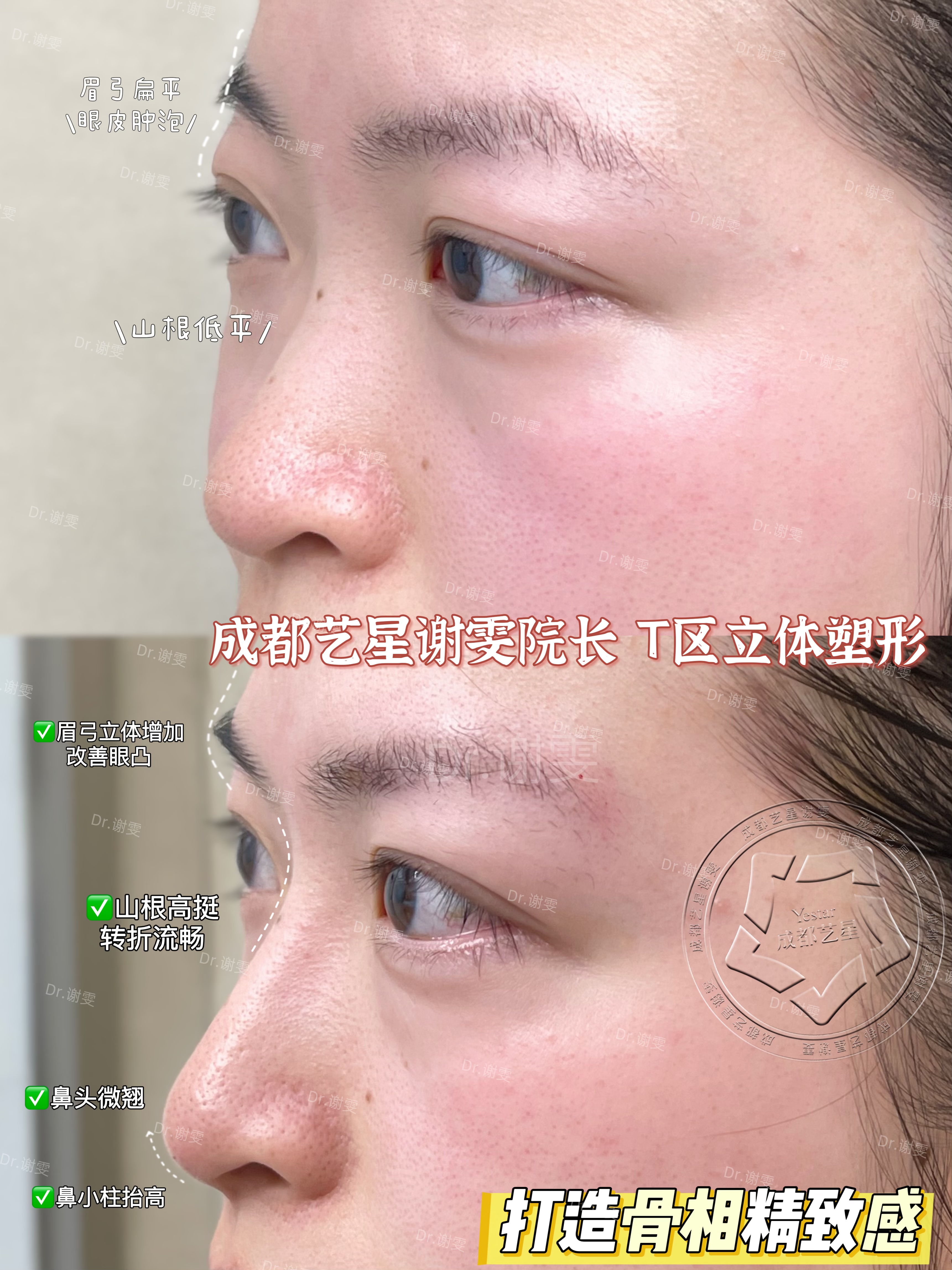 六、成都西區(qū)醫(yī)院宋華敬拉皮與抽脂患者評價