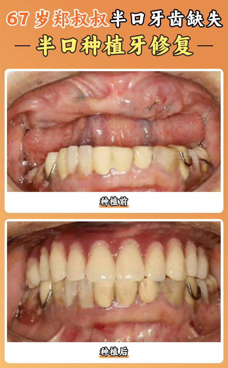 一、西安雙寶口腔醫(yī)院是國(guó)有的嗎？醫(yī)院性質(zhì)大揭秘www.66ub.cn