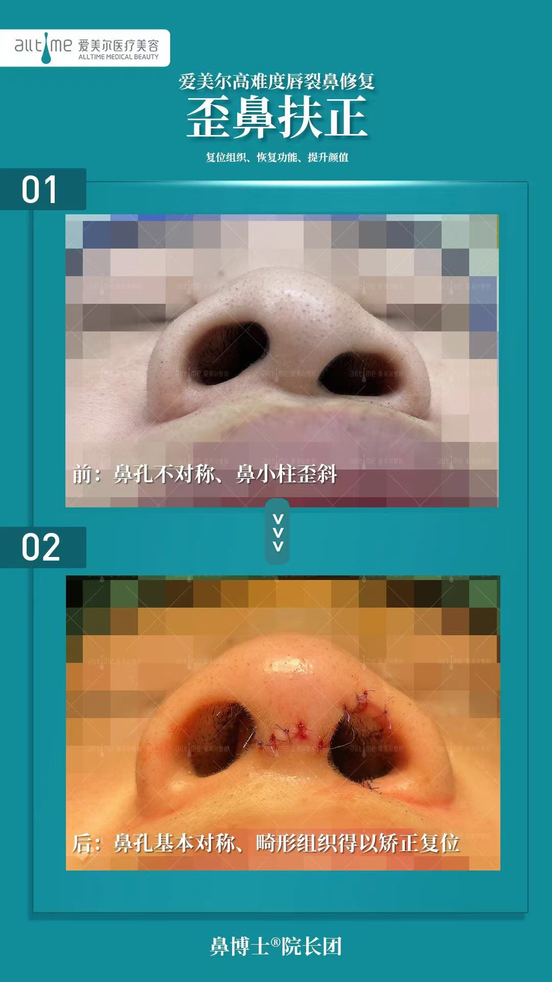 上海九院光子嫩膚價格是多少:患者評價與反饋